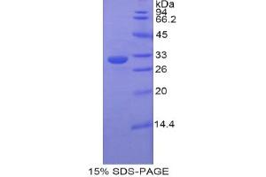 SDS-PAGE analysis of Rat ETFa Protein.