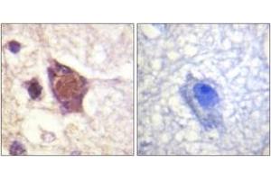 Immunohistochemistry analysis of paraffin-embedded human brain, using DDX3/DEAD-box Protein 3 (Phospho-Thr322) Antibody. (DDX3 antibody  (pThr322))