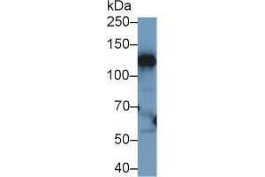 Western blot analysis of Human Liver lysate, using Human CP Antibody (1 µg/ml) and HRP-conjugated Goat Anti-Rabbit antibody ( (Ceruloplasmin antibody  (AA 789-1065))