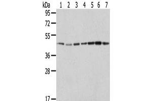 Western Blot analysis of Raji, A549, Hela, HepG2, 231, K562 and A431 cells using ERP44 Polyclonal Antibody at dilution of 1/200 (ERP44 antibody)
