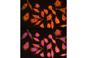 Immunofluorescence analysis of Mouse L929 cells using CK antibody (ABIN6127628, ABIN6138647, ABIN6138648 and ABIN6224627) at dilution of 1:100. (CKAP5 antibody  (AA 1763-2032))