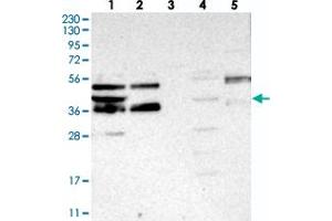 Western blot analysis of Lane 1: RT-4, Lane 2: U-251 MG, Lane 3: Human Plasma, Lane 4: Liver, Lane 5: Tonsil with FEZ2 polyclonal antibody  at 1:250-1:500 dilution.