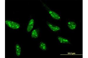 Immunofluorescence of purified MaxPab antibody to SNIP1 on HeLa cell. (SNIP1 antibody  (AA 1-396))
