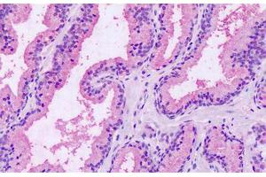 Anti-GPRC5A / RAI3 antibody IHC staining of human prostate.