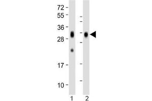 Western blot testing of human 1) spleen and 2) placenta lysate with Folate Receptor beta antibody at 1:1000. (FOLR2 antibody)