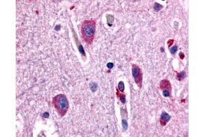 Anti-CHRM2 antibody IHC of human brain, neurons and glia. (Muscarinic Acetylcholine Receptor M2 antibody  (Cytoplasmic Domain))