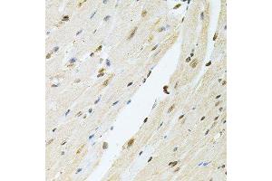 Immunohistochemistry (Paraffin-embedded Sections) (IHC (p)) image for anti-Polynucleotide Kinase 3'-Phosphatase (PNKP) (AA 60-320) antibody (ABIN6145836)