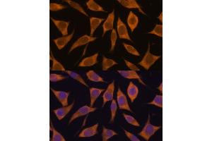 Immunofluorescence analysis of L929 cells using MRPL34 antibody (ABIN7268568) at dilution of 1:100. (MRPL34 antibody  (AA 16-92))