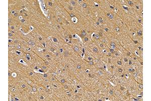 ABIN7094210 and ABIN7098256 at 1/100 staining rat brain tissue by IHC-P. (EXOSC10 antibody  (Internal Region))