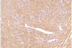 Immunohistochemistry analysis of paraffin-embedded mouse heart using,PSKH1 (ABIN7075291) at dilution of 1: 2800 (PSKH1 antibody)