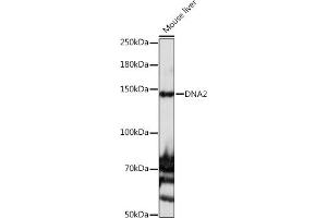 Western blot analysis of extracts of Mouse liver, using DN antibody (ABIN6135118 and ABIN6139689) at 1:1000 dilution. (DNA2 antibody)