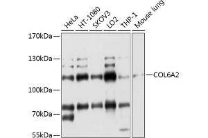 Western blot analysis of extracts of various cell lines, using COL6 antibody (ABIN1679319, ABIN3018110, ABIN3018111 and ABIN6220367) at 1:1000 dilution. (COL6A2 antibody  (AA 720-1019))