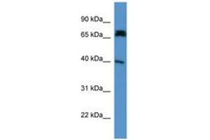 Image no. 1 for anti-Doublecortin Domain Containing 2 (DCDC2) (AA 79-128) antibody (ABIN6746477) (DCDC2 antibody  (AA 79-128))