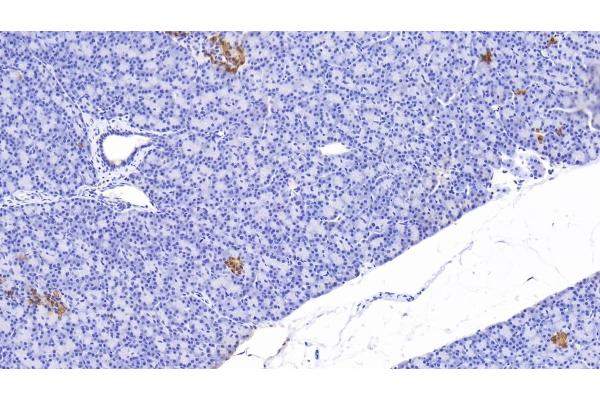C-Peptide antibody