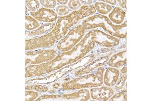 Immunohistochemistry of paraffin-embedded mouse kidney using USP9Y Rabbit pAb (ABIN7271171) at dilution of 1:150 (40x lens). (USP9Y antibody)