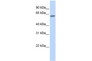 WB Suggested Anti-TBX22 Antibody Titration:  0. (T-Box 22 antibody  (Middle Region))