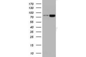 HEK293T cells were transfected with the pCMV6-ENTRY control (Left lane) or pCMV6-ENTRY DGKB (Right lane) cDNA for 48 hrs and lysed. (DGKB antibody)