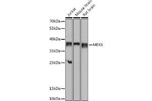Western blot analysis of extracts of various cell lines, using MEK6 antibody (ABIN6130546, ABIN6143490, ABIN6143491 and ABIN6218471) at 1:1000 dilution. (MAP2K6 antibody  (AA 1-334))