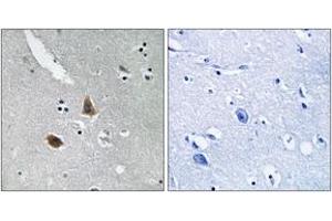 Immunohistochemistry analysis of paraffin-embedded human brain tissue, using MRPL21 Antibody. (MRPL21 antibody  (AA 131-180))