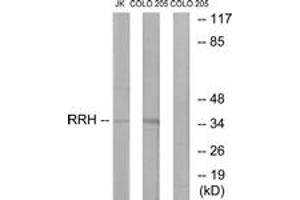 Western blot analysis of extracts from Jurkat/COLO cells, using RRH Antibody. (Peropsin antibody  (AA 201-250))