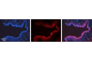 Rabbit Anti-POU5F1 Antibody   Formalin Fixed Paraffin Embedded Tissue: Human Lung Tissue Observed Staining: Cytoplasm Primary Antibody Concentration: 1:100 Other Working Concentrations: N/A Secondary Antibody: Donkey anti-Rabbit-Cy3 Secondary Antibody Concentration: 1:200 Magnification: 20X Exposure Time: 0.