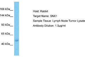 Host:  Rabbit  Target Name:  SNX1  Sample Type:  Lymph Node Tumor lysates  Antibody Dilution:  1.