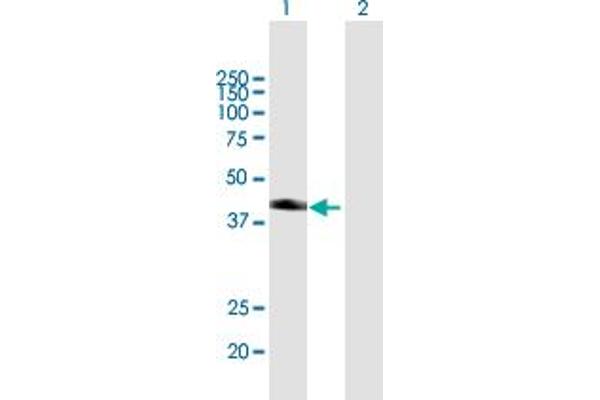 Sorting Nexin 7 抗体  (AA 1-336)