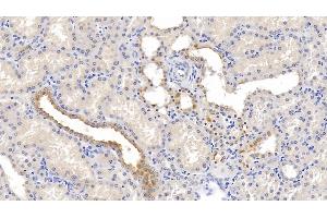 Immunohistochemistry (IHC) image for anti-Poliovirus Receptor-Related 2 (Herpesvirus Entry Mediator B) (PVRL2) (AA 76-353) antibody (ABIN7428758)