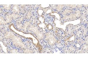 Detection of NECTIN2 in Human Kidney Tissue using Monoclonal Antibody to Nectin 2 (NECTIN2) (PVRL2 antibody  (AA 76-353))