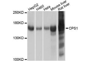Western blot analysis of extracts of various cell lines, using CPS1 antibody. (CPS1 antibody  (AA 820-930))