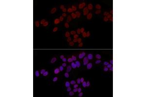 Immunofluorescence (IF) image for anti-Thymopoietin (TMPO) (AA 1-410) antibody (ABIN3016207)