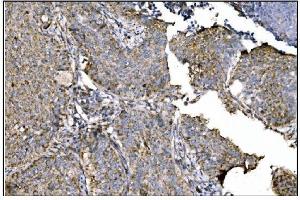 IHC analysis of Ornithine Aminotransferase/OAT using anti-Ornithine Aminotransferase/OAT antibody (ABIN7600649). (OAT antibody  (AA 214-439))