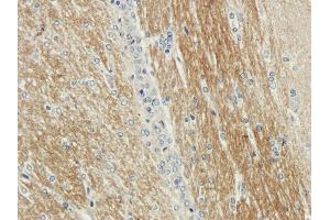 Immunohistochemical staining of rabbit brain using anti-CDCrel-1 antibody ABIN7072252 Formalin fixed rabbit brain slices were were stained with ABIN7072250 at 3 μg/mL. (Recombinant Septin 5 antibody)
