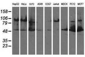 Image no. 2 for anti-Dihydrolipoamide Dehydrogenase (DLD) antibody (ABIN1497849) (DLD antibody)