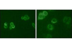 Immunofluorescence analysis of Hela (Left) and MCF-7 (Right) cells using Tyro3 mouse mAb (green). (TYRO3 antibody  (AA 138-321))