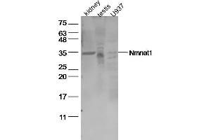 Lane 1: Mouse kidney lysates, Lane 2: Mouse testis lysates, Lane 3: U937 Cell lysates, probed with Nmnat1 Polyclonal Antibody, unconjugated (bs-11738R) at 1:500 overnight at 4°C followed by a conjugated secondary antibody for 60 minutes at 37°C.