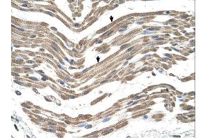 C1QB antibody was used for immunohistochemistry at a concentration of 4-8 ug/ml. (C1QB antibody  (C-Term))