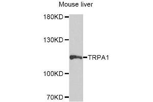 Western blot analysis of extracts of mouse liver, using TRPA1 antibody (ABIN5996346) at 1/1000 dilution. (TRPA1 antibody)