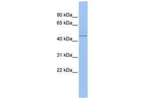 Image no. 1 for anti-Promyelocytic Leukemia (PML) (AA 35-84) antibody (ABIN6742751) (PML antibody  (AA 35-84))