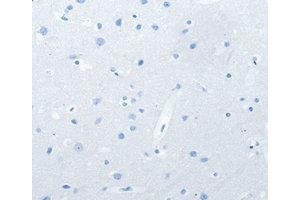 Immunohistochemistry (IHC) image for anti-Neurofascin (NFASC) antibody (ABIN1873888)
