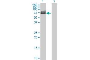 Western Blot analysis of ALPL expression in transfected 293T cell line by ALPL MaxPab polyclonal antibody. (ALPL antibody  (AA 1-524))