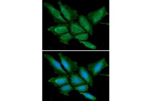 ICC/IF analysis of BPGM in HeLa cells line, stained with DAPI (Blue) for nucleus staining and monoclonal anti-human BPGM antibody (1:100) with goat anti-mouse IgG-Alexa fluor 488 conjugate (Green). (BPGM antibody)