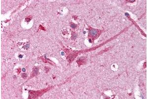 Human Brain, Cortex (formalin-fixed, paraffin-embedded) stained with NEK9 antibody ABIN218339 at 1:50 followed by biotinylated goat anti-rabbit IgG secondary antibody ABIN481713, alkaline phosphatase-streptavidin and chromogen. (NEK9 antibody)
