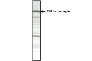 Total protein extract of normal human cerebral cortex separated as a strip on a 3-12. (Huntingtin antibody  (AA 2703-2911))