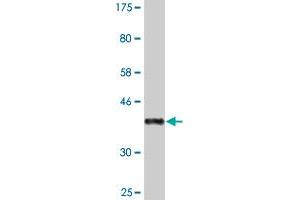 Western Blot detection against Immunogen (36. (PRMT3 antibody  (AA 41-139))