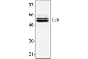 Western Blotting (WB) image for anti-Lymphocyte-Specific Protein tyrosine Kinase (LCK) antibody (ABIN2665225) (LCK antibody)