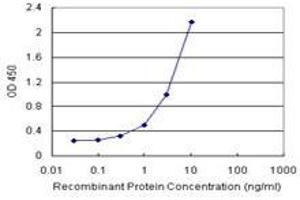 Sandwich ELISA detection sensitivity ranging from 0. (COMMD1 (Human) Matched Antibody Pair)