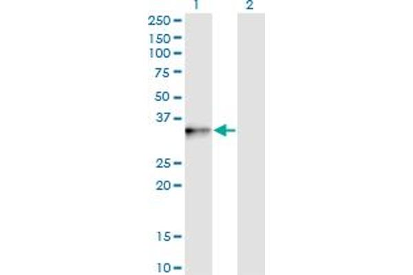 PIH1D1 antibody  (AA 1-290)