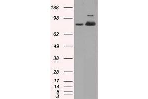 HEK293T cells were transfected with the pCMV6-ENTRY control (Left lane) or pCMV6-ENTRY ACO2 (Right lane) cDNA for 48 hrs and lysed. (ACO2 antibody)