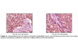 Image no. 1 for anti-Glycogen Synthase Kinase 3 alpha (GSK3a) antibody (ABIN232113) (GSK3 alpha antibody)